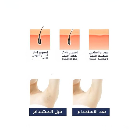 جهاز ليزر APL لازالة الشعر نصف مليون ومضة